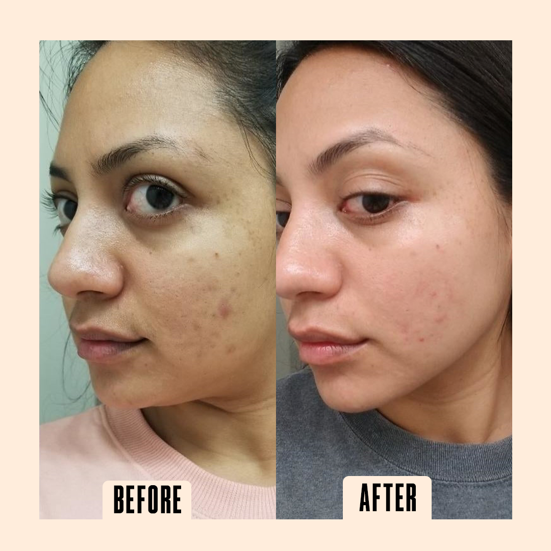 Natrolish Rice Ceramide Moisturizer